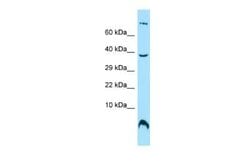 OST4 Rabbit anti-Human, Polyclonal, Novus Biologicals 100 &mu;g; Unconjugated:Antibodies,